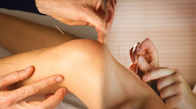 Acupuncture: Ancient Technique Improving the Quality Of Life